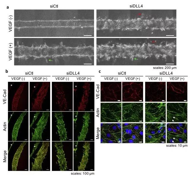 敲除DLL4將影響血管的新生和穩(wěn)定性。圖片來源：EBioMedicine